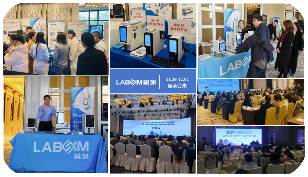 JBO��Ѷ����