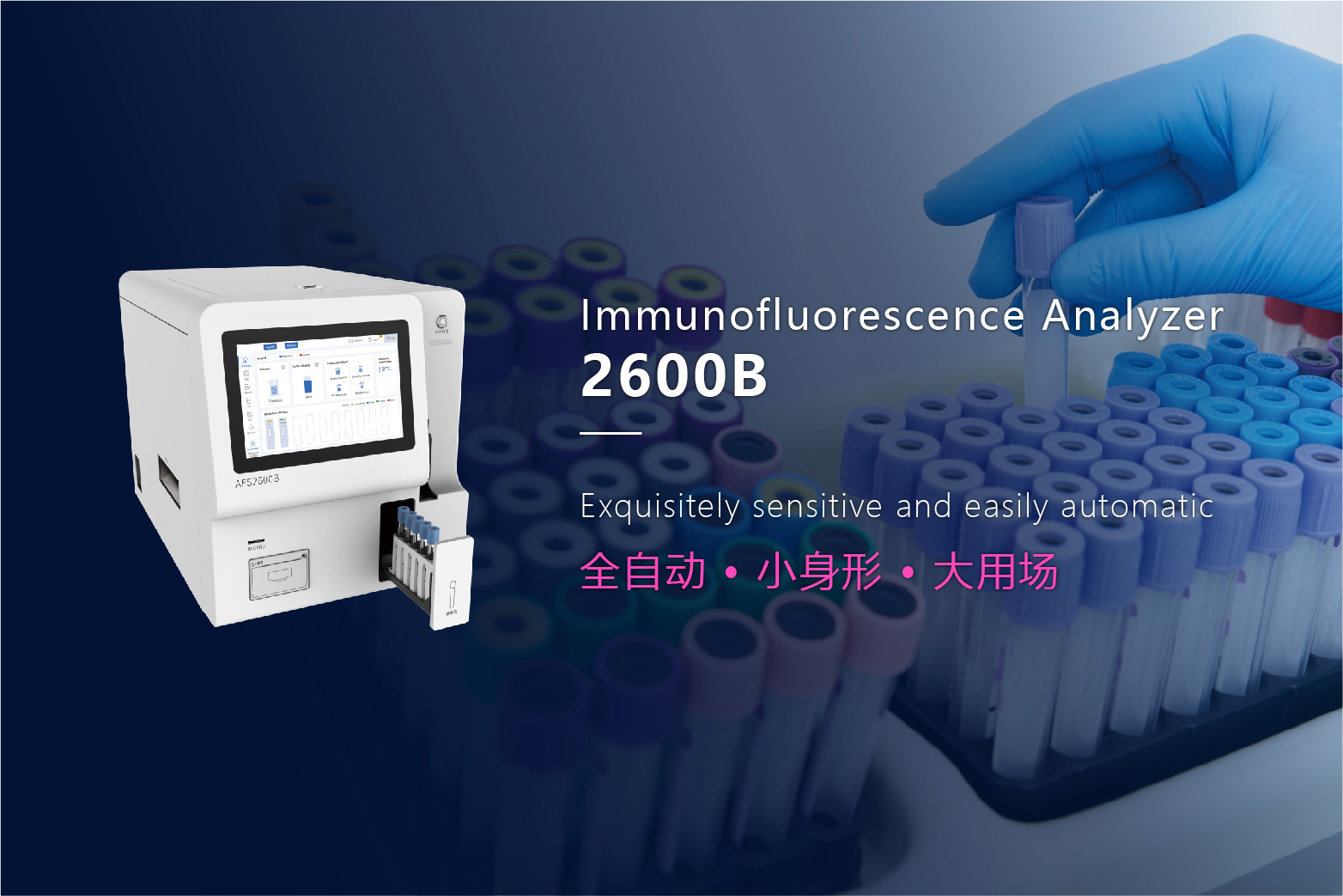 JBO��Ѷ����